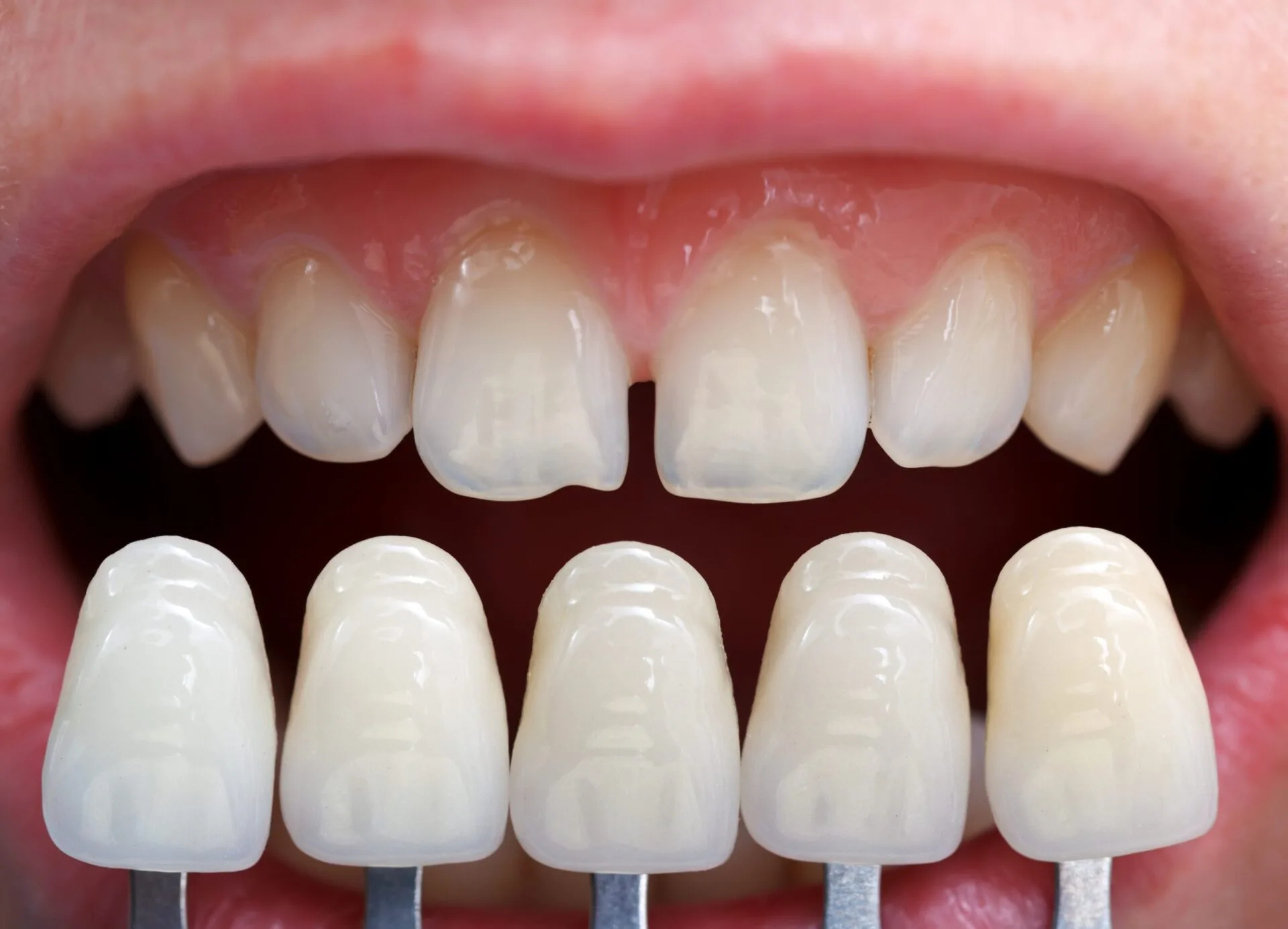 Dr. Shahram Valiani DDS – Advanced Dental Techniques for Better Results